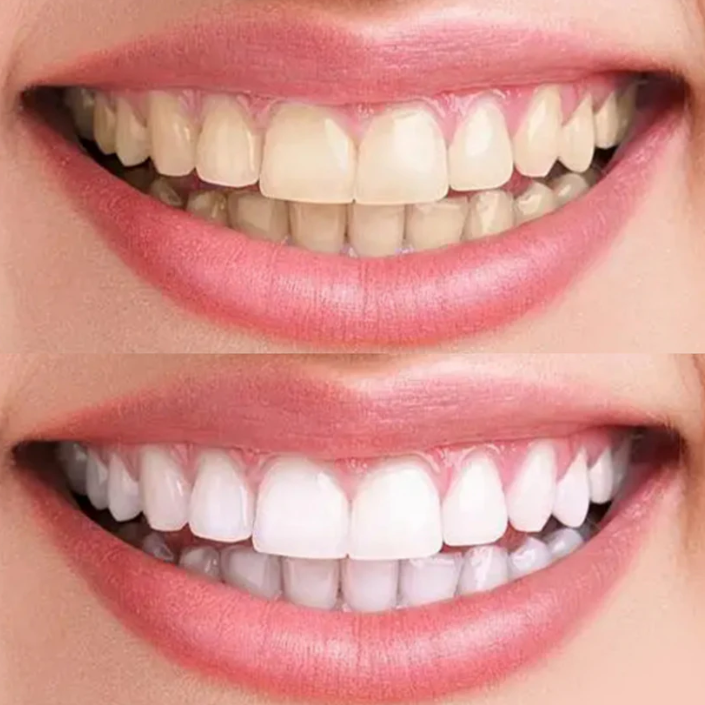 "Weix - Dental Care ProBrush" - Handzahnbürste